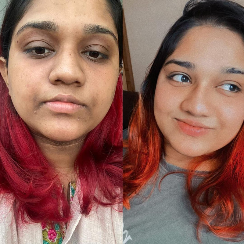 Nanditha before and after
