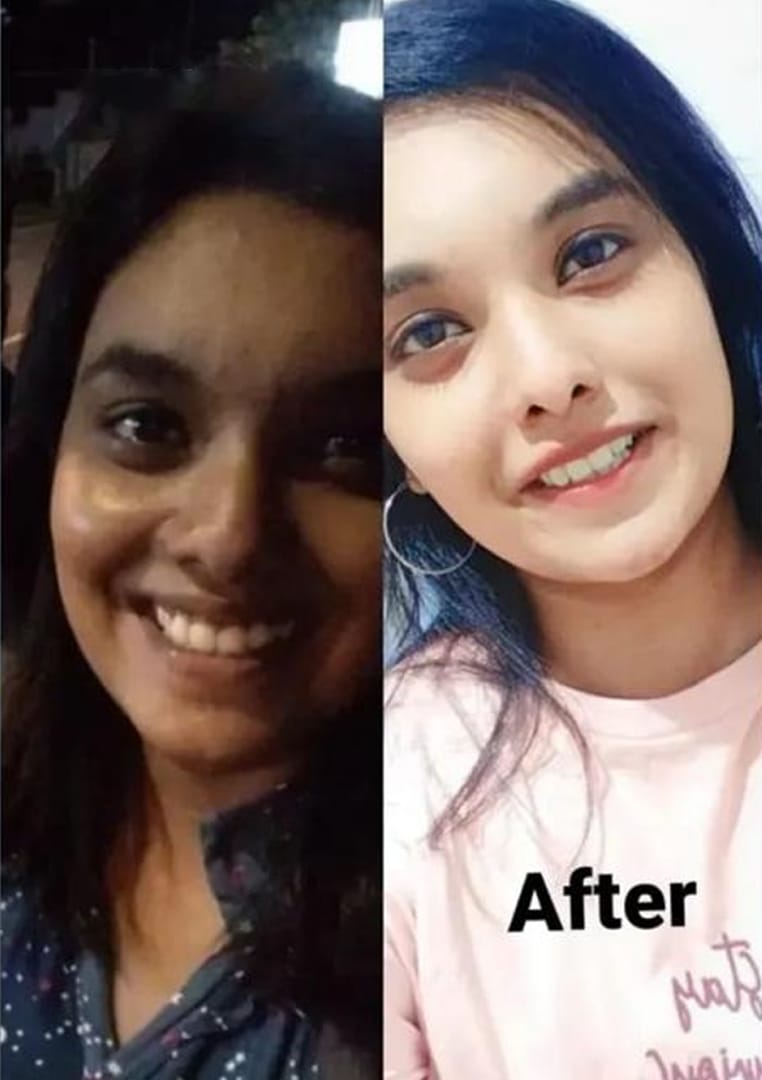 Anusha before and after