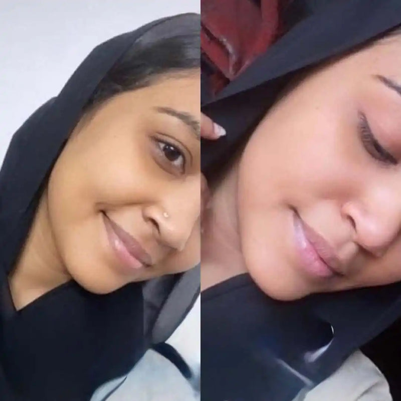 Fathima before and after