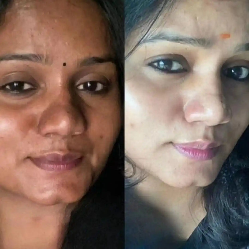 Meera before and after