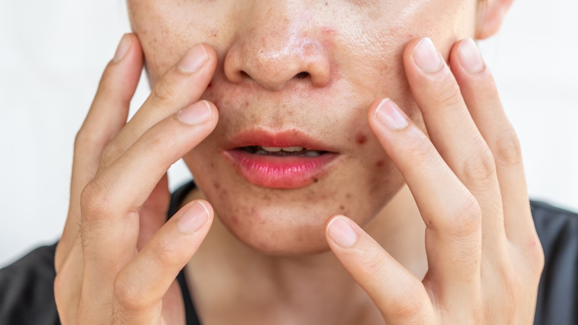 Best Skin Products for Oily Skin: Top Picks for Shine-Free, Clear Skin