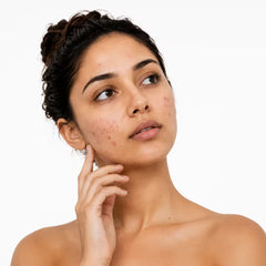 Dark Spots