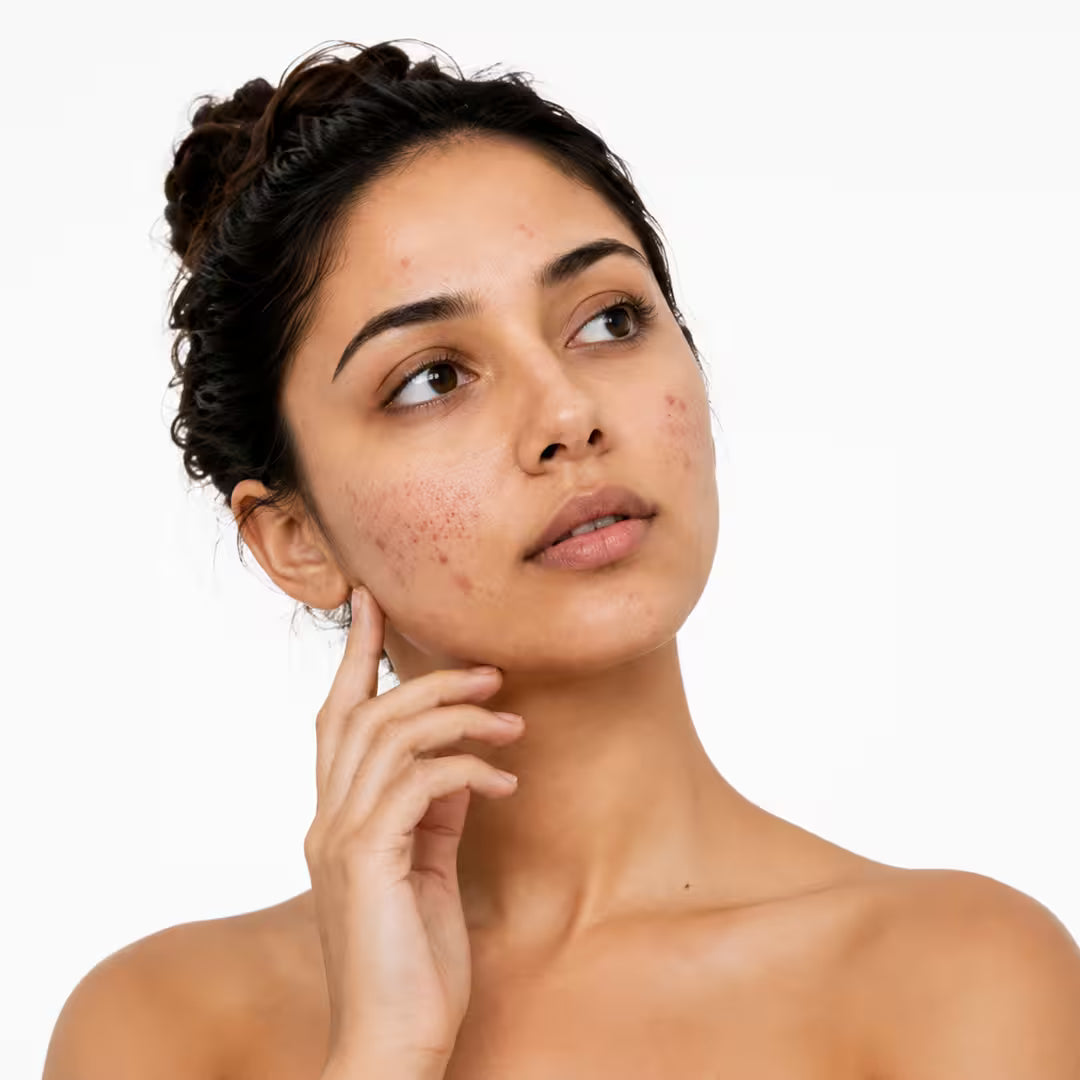 Pigmentation & Dark Spots