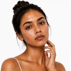 Oily Skin