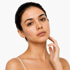 Pimple & Acne