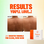 Beauty Cream + Beauty Soap FREE