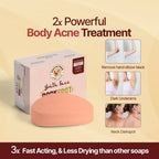 DarkSpot Remover Soap (100g)