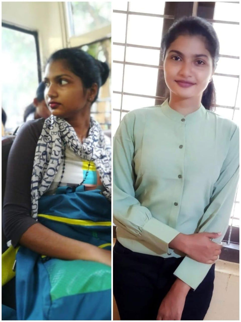 Keerthana T. before and after