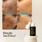 Night Serum (30ml)