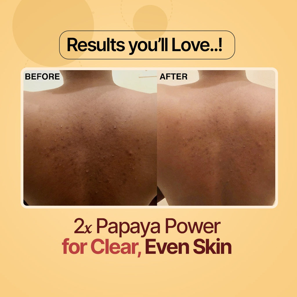Papaya Beauty Bar Skin Brightening | Papaya Extracts | Gentle On Skin | Refreshing Lather (75g)