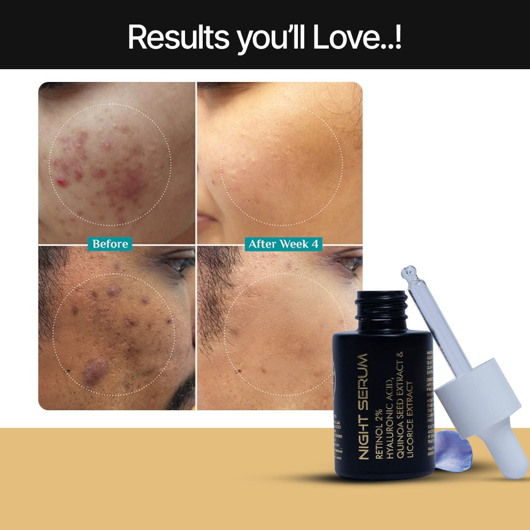 Youthface Night Serum | Overnight Repair | Intense Hydration | Glowing Skin By Morning | Lightweight Texture (30ml)