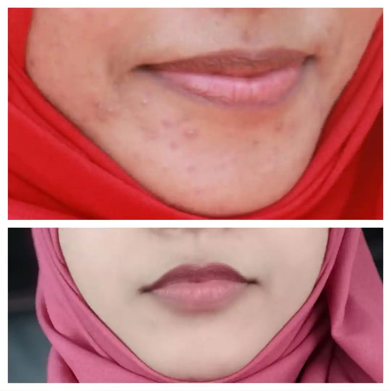 Fida before and after